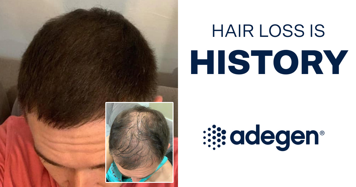 Aderans BeautEffector Scalp & Skin Pro Scalp Detoxifier - Scalp