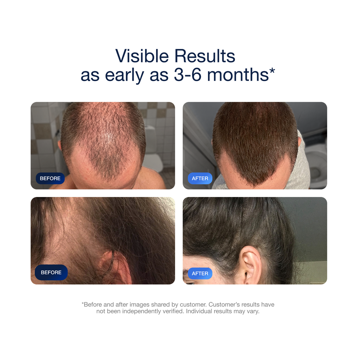 people before and after when using adegen products