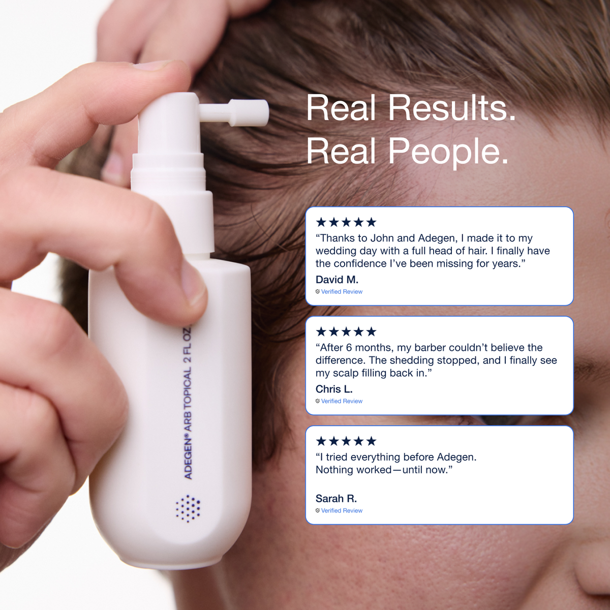 testimonials from people who have had success with adegen hair growth products