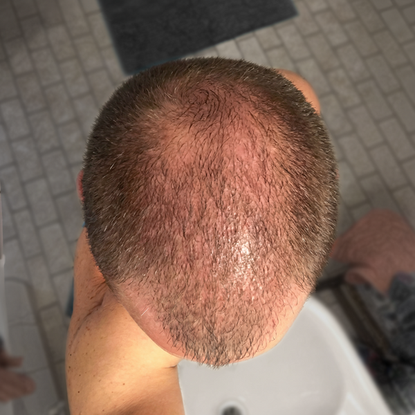 Day 14