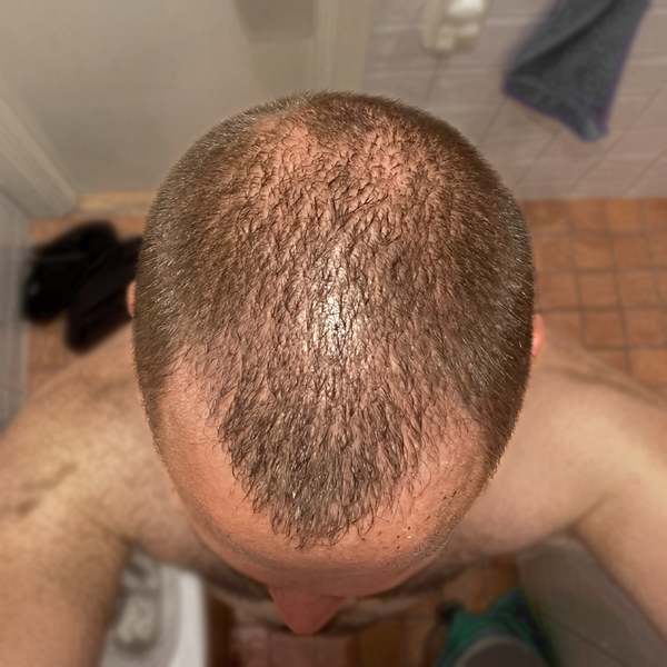 Day 30