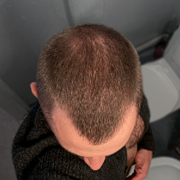 Day 60