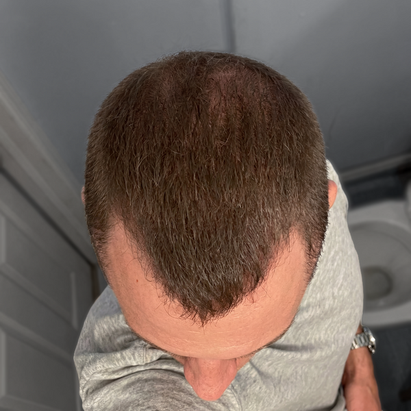 Day 90